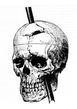 Phineas Gage